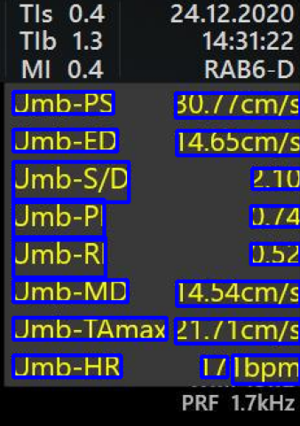 Text identified and bounded by blue boxes